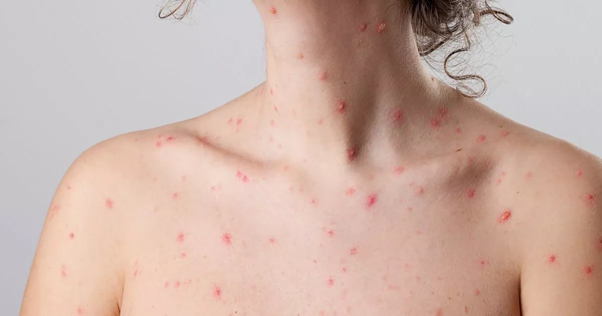 Cập nhật xu hướng mới nhất trong đá gà hiện nay